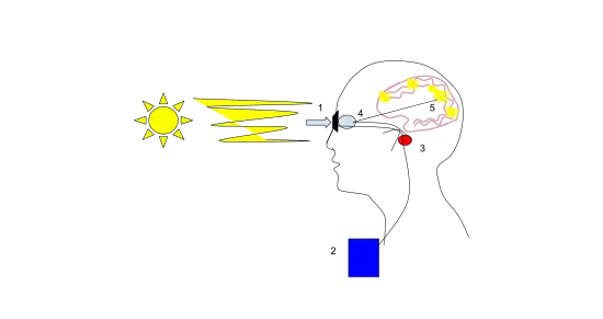 Gli occhi bionici sono talvolta usati per aiutare i non vedenti. Il diagramma illustra come funziona il processo. Inizialmente, il paziente riceve un impianto nella retina. Gli occhiali indossati hanno telecamere in miniatura nell'obiettivo, che inviano quindi segnali al chip impiantato situato nella retina. Quindi, il chip converte questi segnali in impulsi elettrici che possono essere inviati al nervo ottico ed elaborati come un'immagine nel cervello.