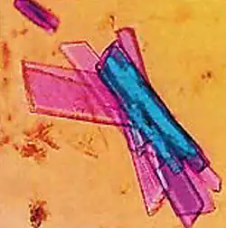 Modello tridimensionale dell'enzima