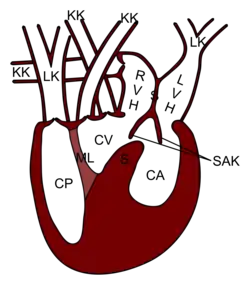 Anatomia: RVH= atrio destro; LVH= atrio sinistro; KK= circolazione sistemica; LK= circolazione polmonare; SAK= valvole del setto atrioventricolare; CP= cavità polmonare.